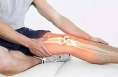 “16连蹲”伤膝盖 运动要量力而行 做好这三点远离骨质疏松