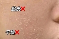 干燥脱皮？秋冬季护肤指南来了