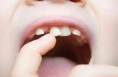 不吃糖的孩子为何也会蛀牙？