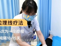 【健康渭南】埋线减肥见成效   小伙半月瘦10斤