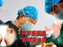 【健康渭南】常穿高跟鞋   警惕拇外翻