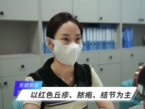 【健康渭南】战痘有道 精准护肤——注重痤疮早干预 预防减少后遗症
