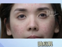 以為很護膚，其實這些行為很傷臉！