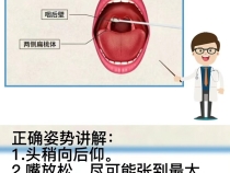 核酸检测正确打开方式