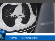 【渭南科普】“白肺”能彻底恢复吗？
